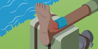 VERRENKUNGEN UND VERSTAUCHUNGEN? WENDEN SIE DIE PECH-MASSNAHMEN AN.