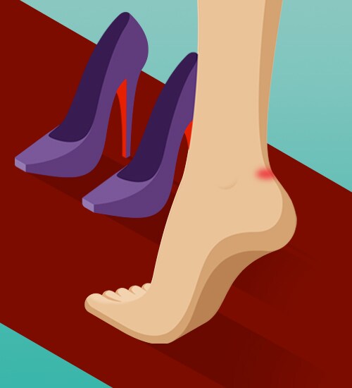 BOUNCE BACK FROM BLISTERS
