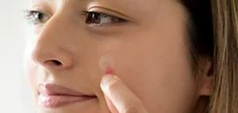 Nexcare™ Aknepflaster
