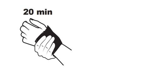 Handgelenk umgeben von einer Gelpackung
